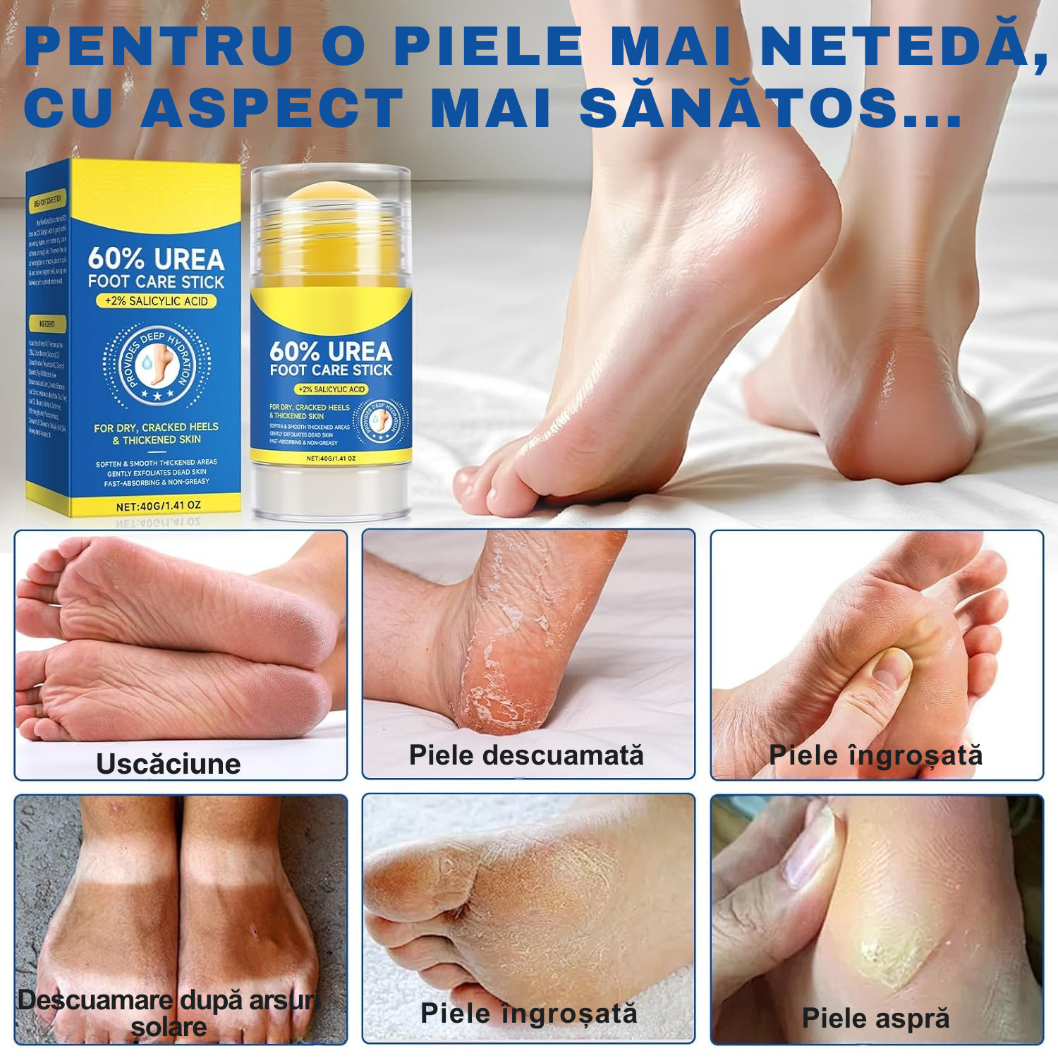 Stick Pentru Călcâie cu Uree 60% și Acid Salicilic 2%