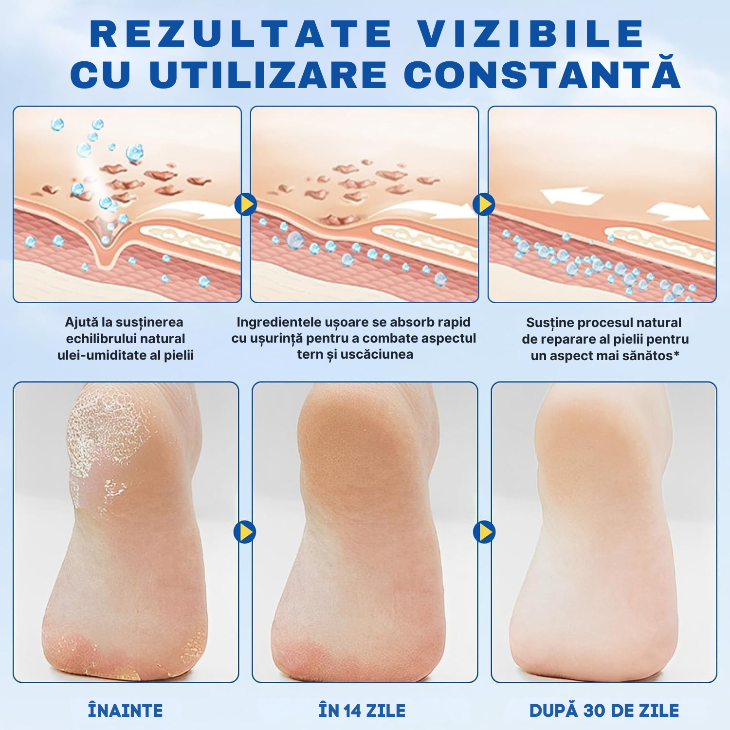 Stick Pentru Călcâie cu Uree 60% și Acid Salicilic 2%